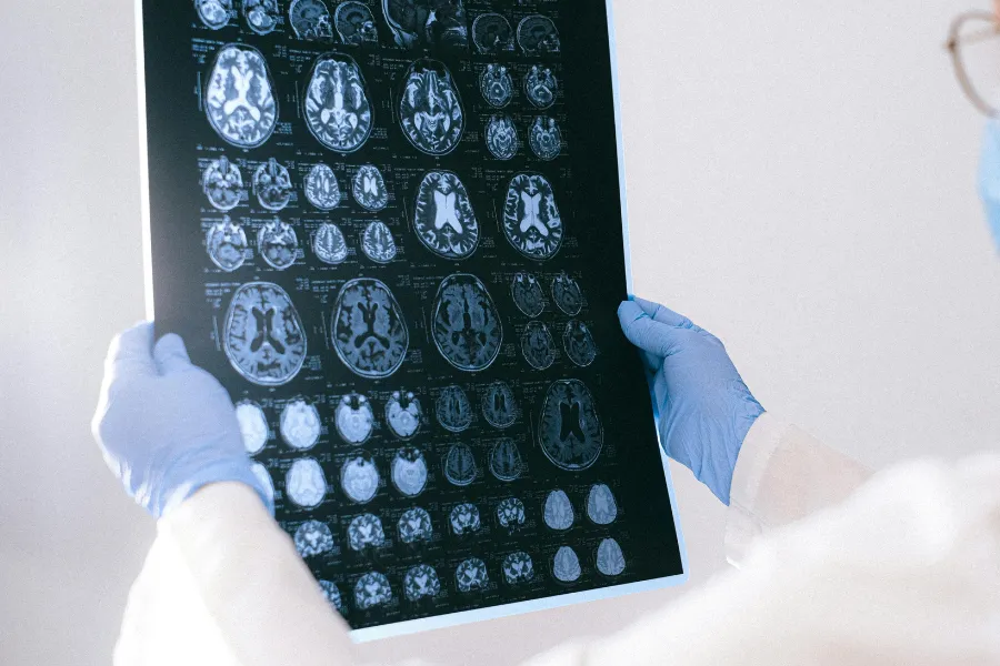 prueba diagnóstica del cerebro